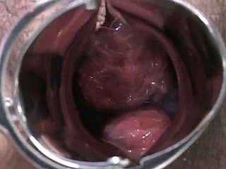 गर्भवती जापानी महिला की जांच की और डॉक्टर के lollicock बेकार है