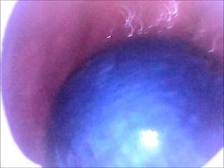 My aggravation swallows 2 chinese natter on with an increment of 2 pool natter on